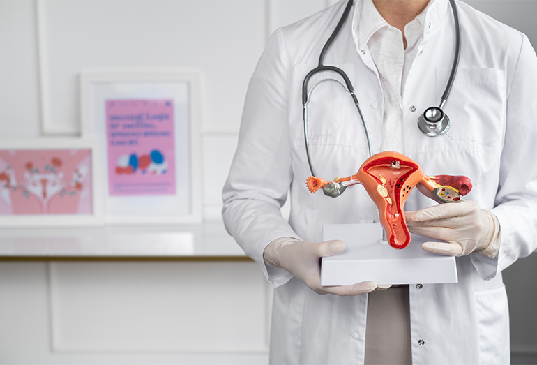 what-are-the-best-treatment-options-for-pcos-polycystic-ovarian-syndrome?